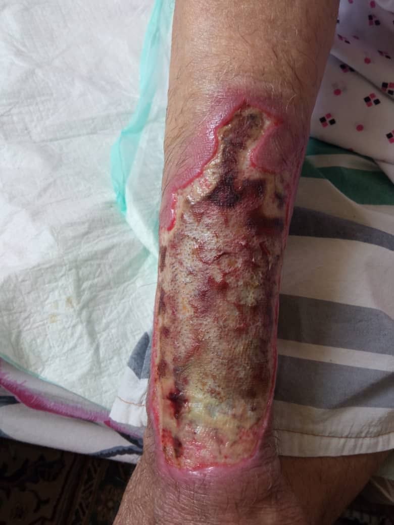 اولین مراجعه