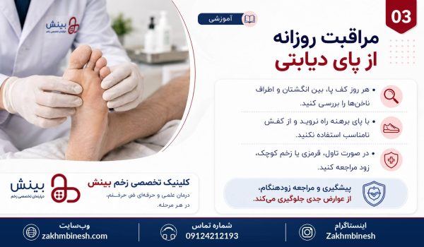 مراقبت از زخم پای دیابتی کلینیک زخم بینش