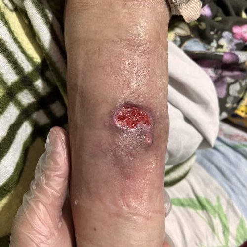 2 اواسط درمان